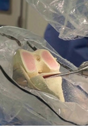 robotic joint surgery in phagwara